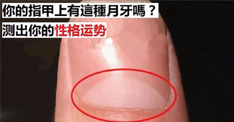 你的大拇指上有这种月牙吗?